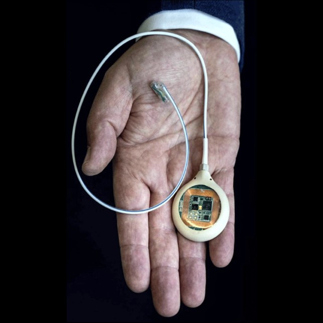 Synergia Medical SHUTE 3